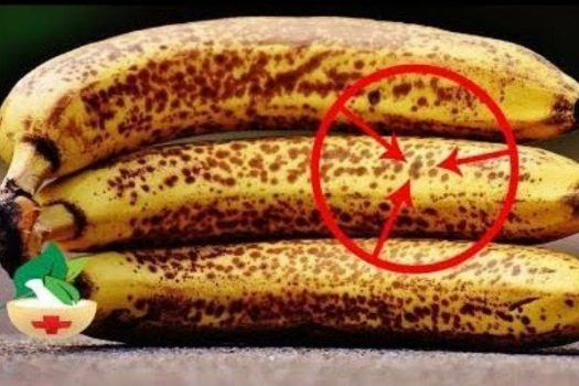 Ώριμες μπανάνες με μαύρα στίγματα: Τι συμβαίνει στο σώμα σας όταν τις καταναλώνετε